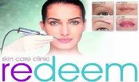 Redeem Semi permanent makeup and Tattoo removal, Whitby 379657 Image 7